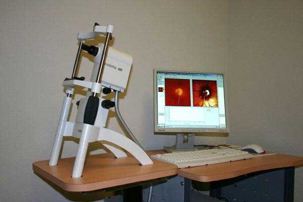 heidelberg-retina-tomograph